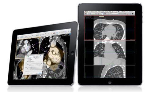 Un cinese si vende un rene per un iPad 2