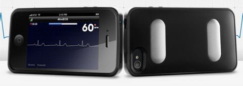 AliveCor