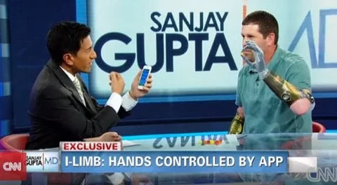 i-Limb, il braccio robotico comandato con un iPhone 1 i-Limb