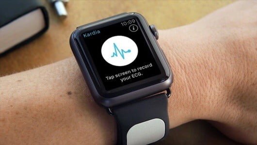 Kardia Band, il cinturino che realizza un ECG medico con l'Apple Watch 1 Kardia Band