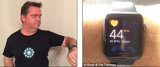 L'Apple Watch gli rileva un'anomalia cardiaca e lui si salva 1 Apple Watch cuore