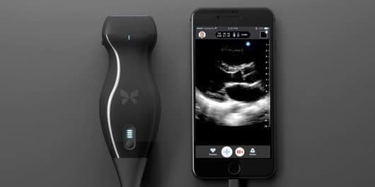 Butterfly IQ, il dispositivo per fare ecografie con l'iPhone 1 Butterfly IQ