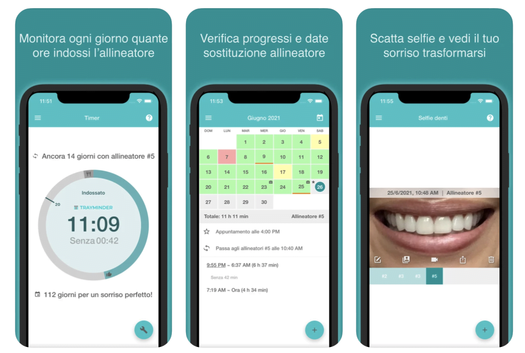 Le App Per Invisalign, Come Gestire Gli Aligner Trasparenti