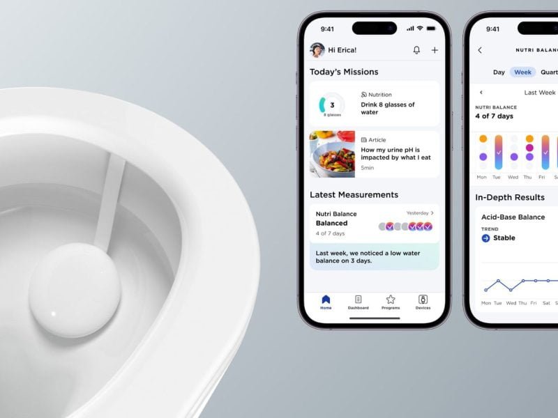 Withings U-Scan
