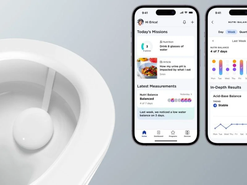 Withings U-Scan