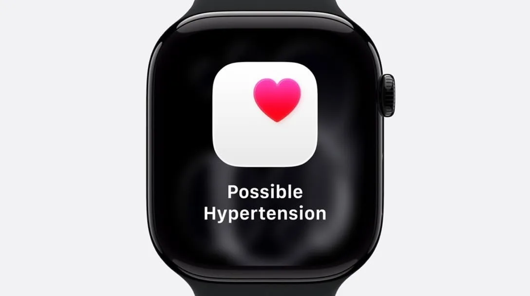 Apple Watch 11 1